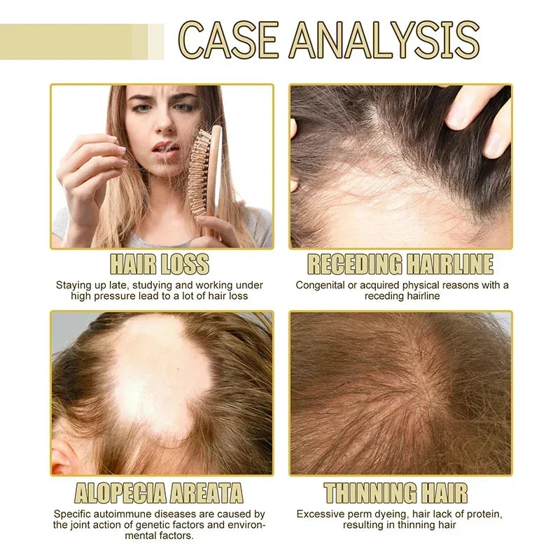 60ml Hair Essential Oil Repair Hairs Damage Prevent Hair Loss Nourish Care Oil